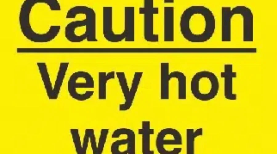 Childhood Burns On The Rise At IWK