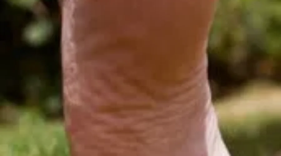 Barefoot In the New Brunswick Legislature For a Great Cause