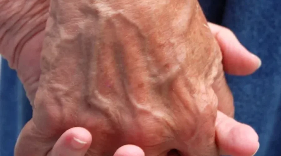 Visits At Veterans Centre Restricted Due To Gastroenteritis