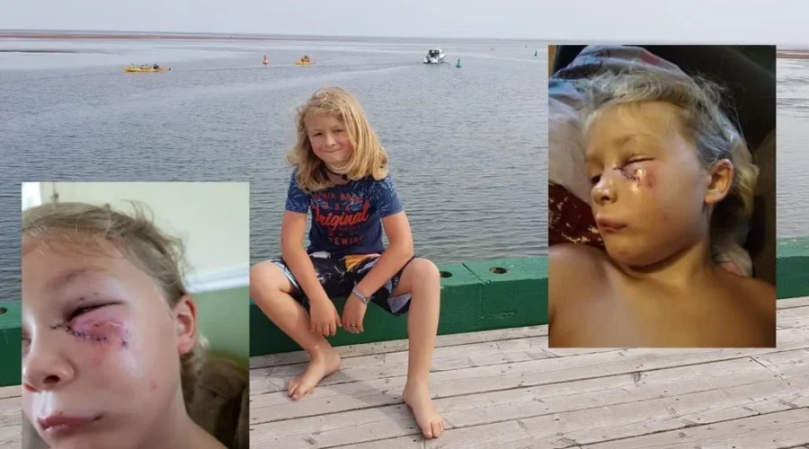 NB SPCA Investigating As Boy Recovers From Dog Attack