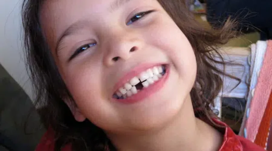 COVID-19 Impacts Dental Procedures