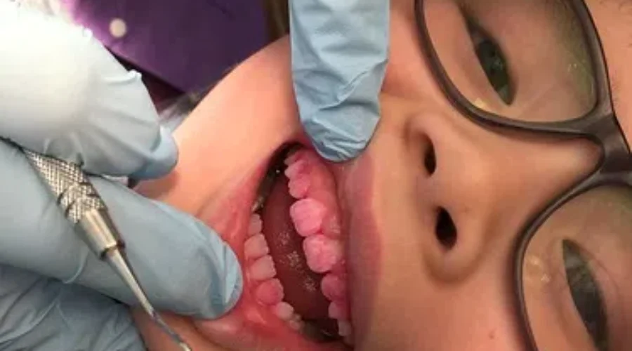 Dental Services Resume This Week