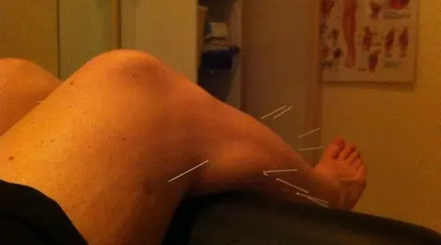 Local Naturopathic Therapist Disappointed With Delay For Some Healthcare Services