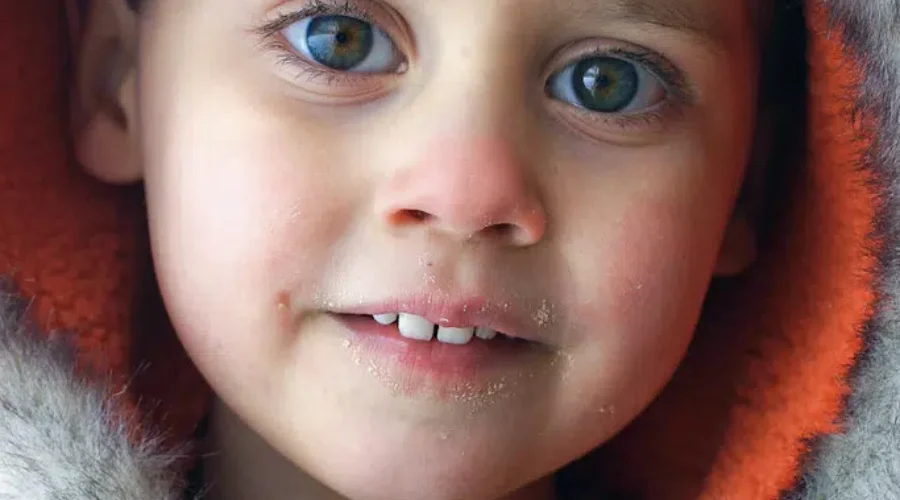 Moncton Headstart needs Coats for Kids