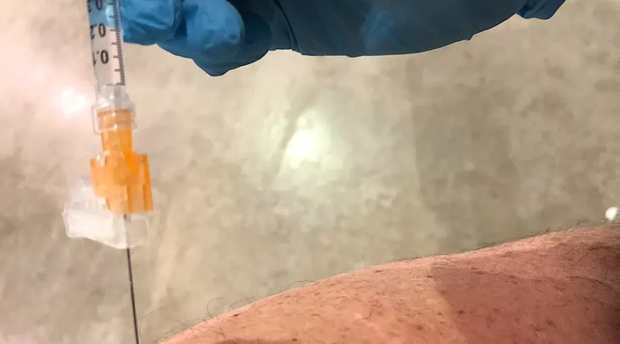 N.B. residents urged to check measles vaccine status