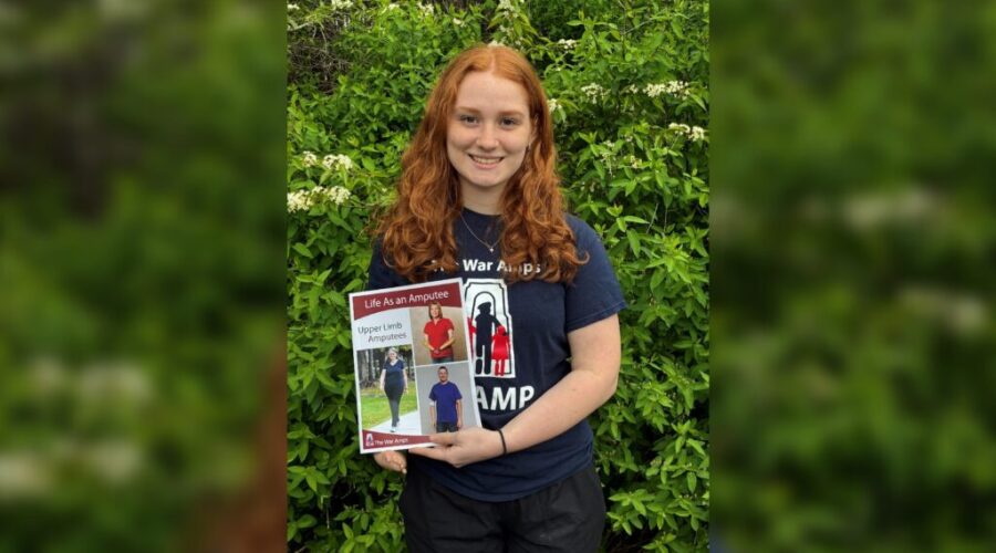 N.B. amputee inspiring others through War Amps